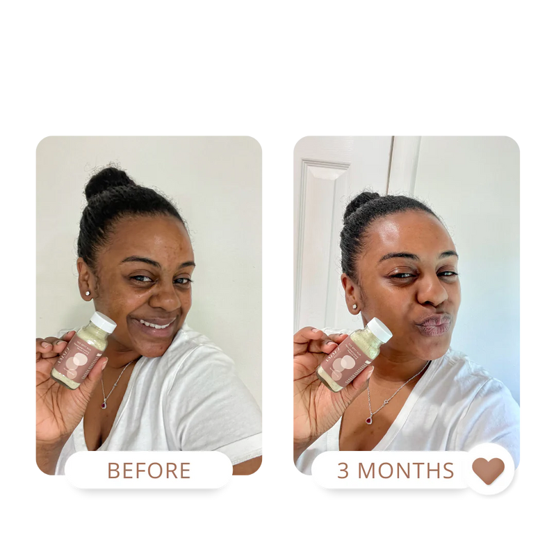 THE GLOW UP | DRY SKIN KIT