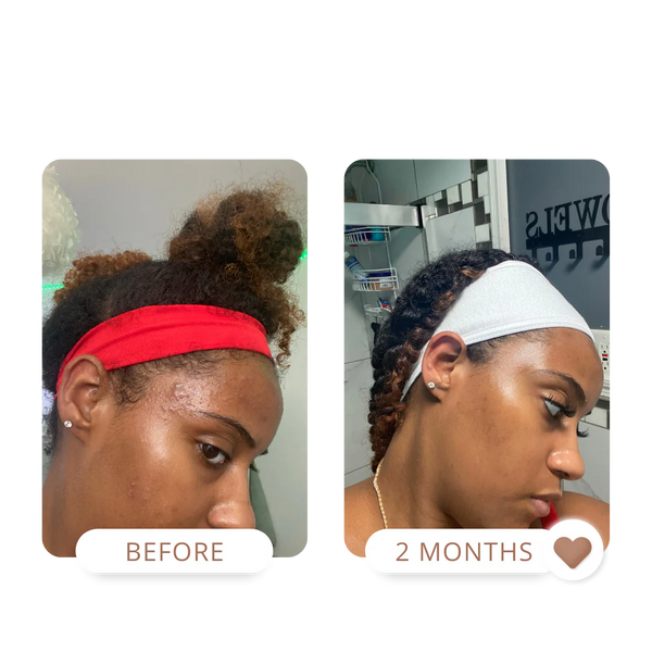 MATTE MADE IN HEAVEN | OILY SKIN KIT