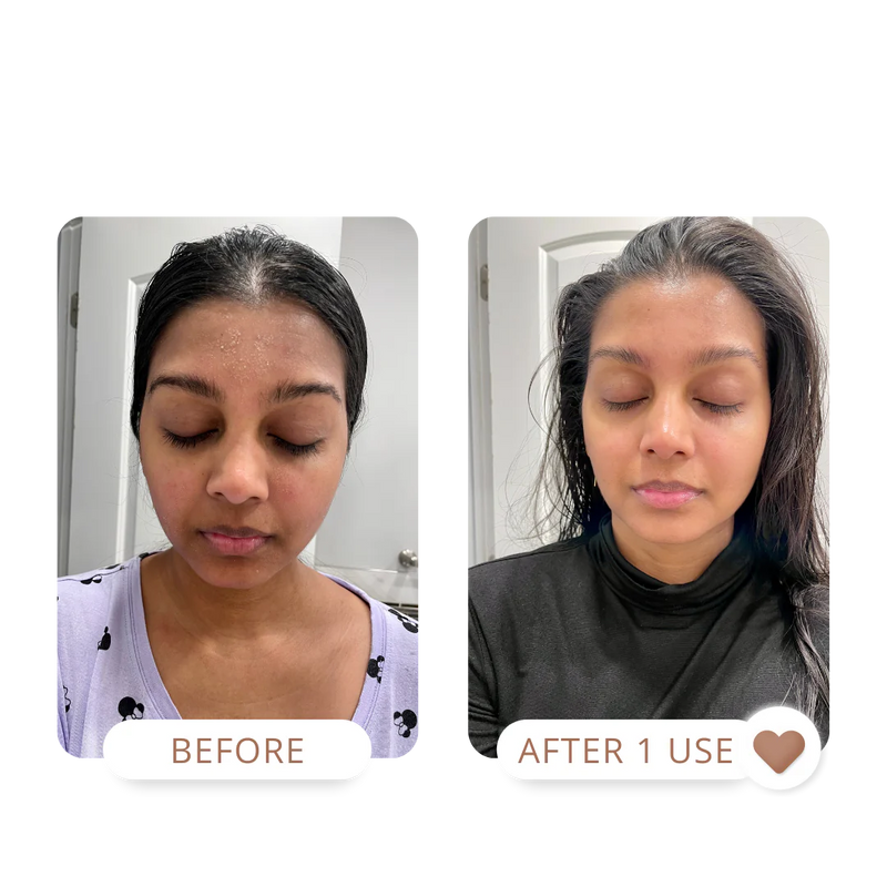 THE GLOW UP | DRY SKIN KIT